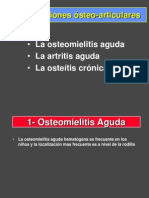 Osteomielitis Agudas