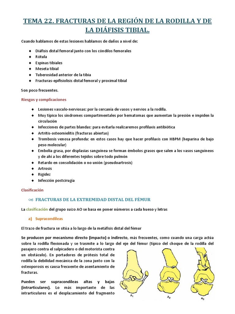 Oa Clasificacion Rodilla Sistema Musculoesqueletico