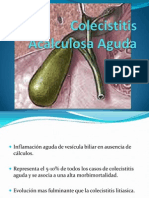 Colecistitis Acalculosa Aguda