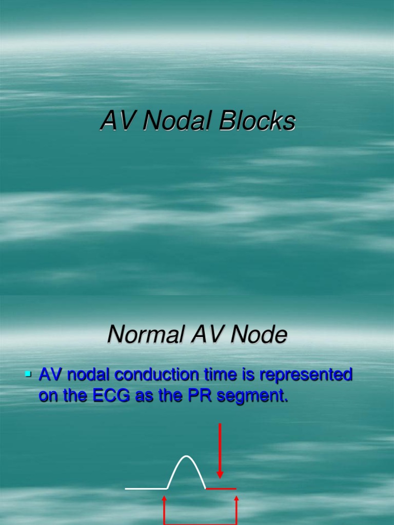 AV Nodal Blocks PDF Heart Cardiac Arrhythmia