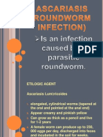 Ascariasis