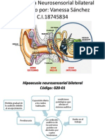 Hipoacusia Neurosensorial Bilateral