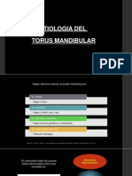 Etiologia Del Torus Mandibular