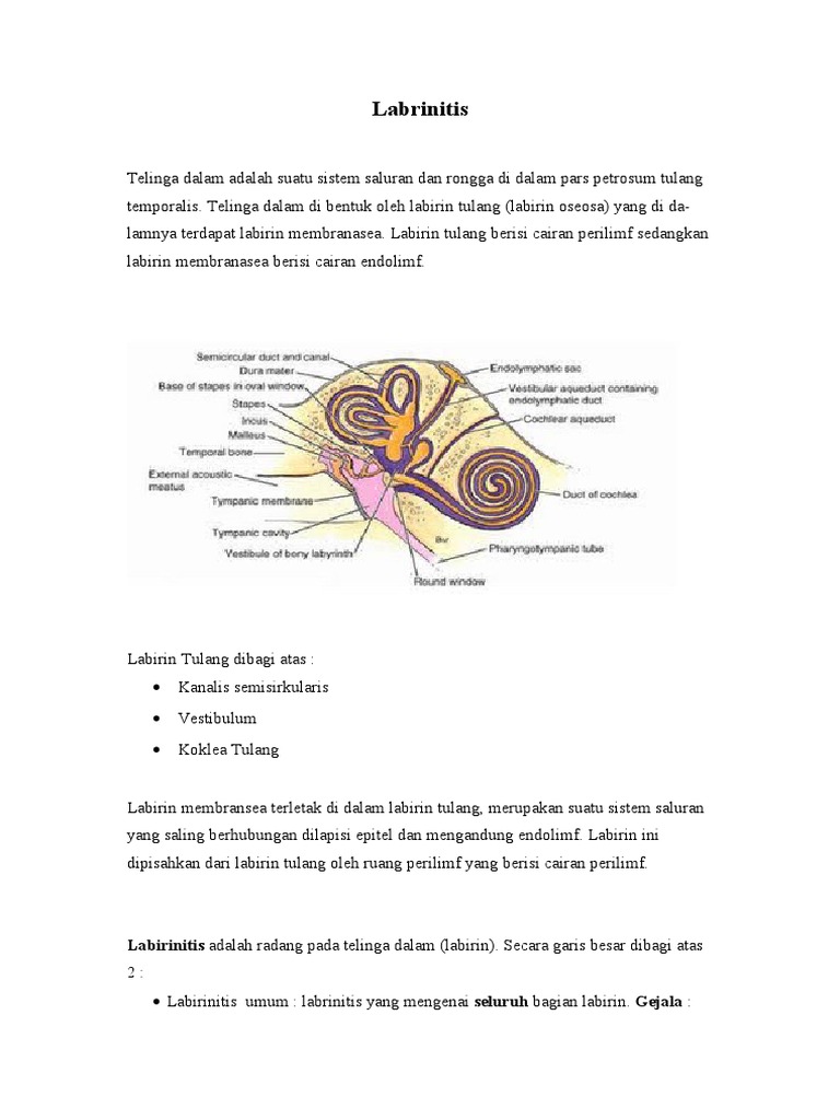 Labirinitis | PDF