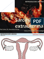Curs 5 - Sarcina Extrauterina