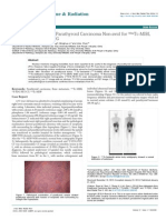 Bone Metastasis From Parathyroid Carcinoma Nonavid For Mtcmibi MTCMDP and FFDG 2155 9619.1000165