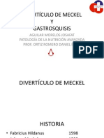 Divertículo de Meckel y Gastrosquisis