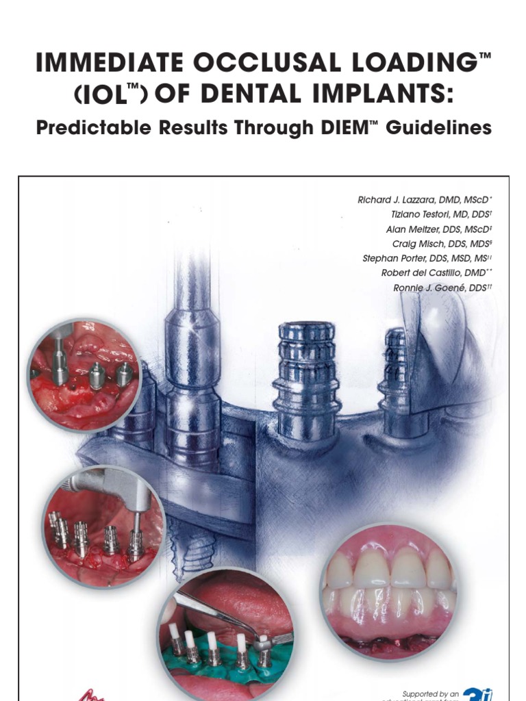 IMMEDIATE OCCLUSAL LOADING™ (IOL™) OF DENTAL IMPLANTS PDF Dental