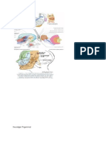 Neuralgia Trigeminal