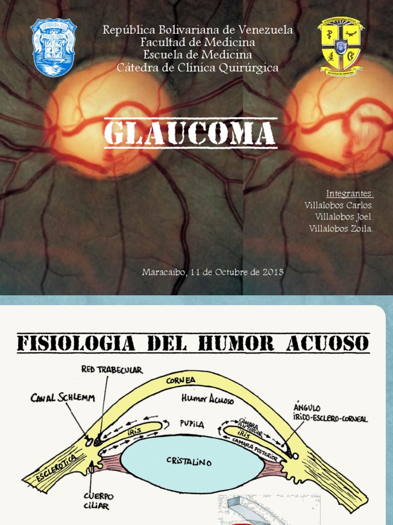 Diagnóstico y Tratamiento del Glaucoma | PDF | Percepción visual ...