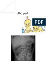 Abdomen Pediatri