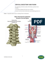 Acdf Cervical