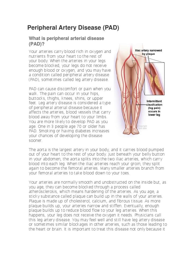 Peripheral Artery Disease Overview | PDF | Artery | Angiography