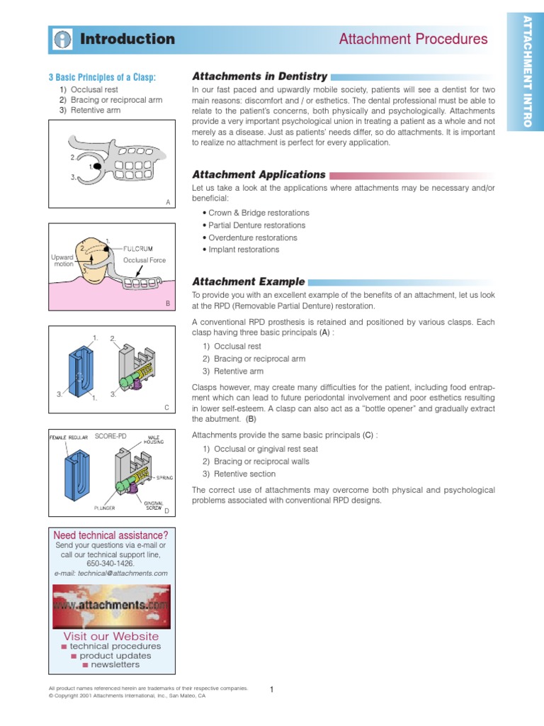 Attachment Procedures: Attachments in Dentistry | PDF | Dental Implant ...