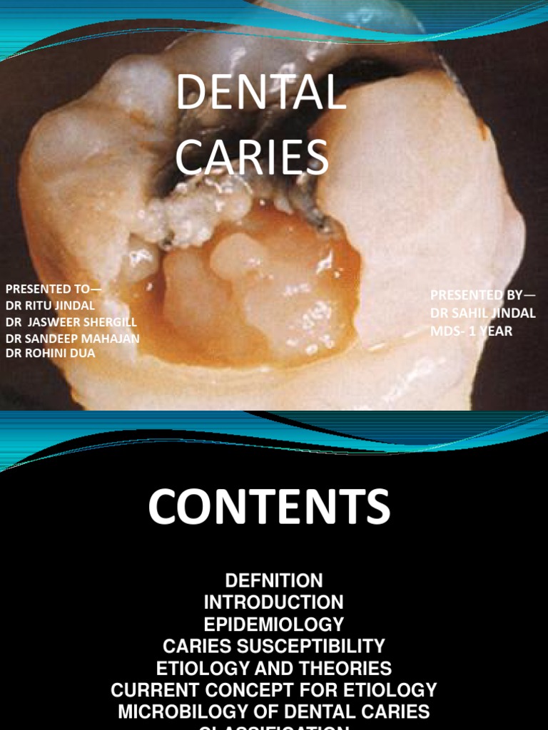 Overview of Dental Caries Factors | PDF | Tooth Enamel | Dentin