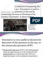 Tonometry is a Method of Measuring the Pressure