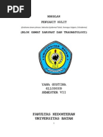 Download Makalah Seminar Penyakit Kulit Berkaitan Dgn Oral Medicine by WellyAnggarani SN230630745 doc pdf