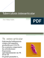 Tuberculosissteoarticular 130704091343 Phpapp02