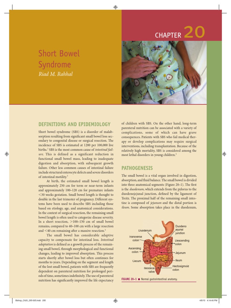 Short Bowel Syndrome Guide | PDF | Small Intestine | Gastrointestinal Tract