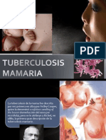 Tuberculosis Mamaria