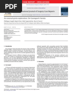 Hernia de Garengerot