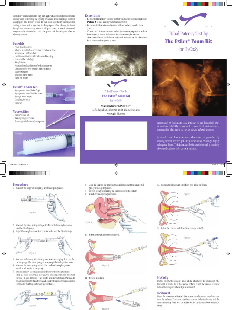 ExEm Foam Kit New Folder HighResolution 20 Jan 2011 Syringe