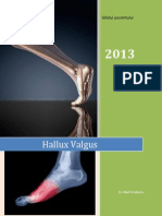 Hallux Valgus