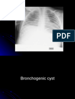 6th y chest x-ray