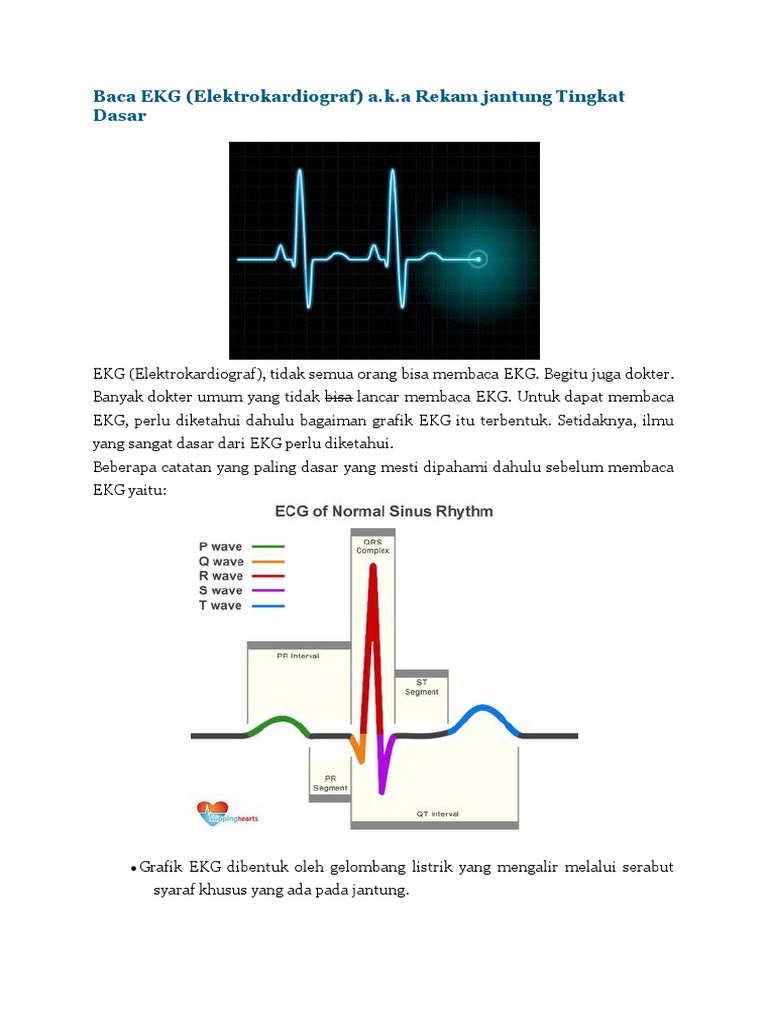 Download 580 Gambar Grafik Ekg Normal Paling Baru HD