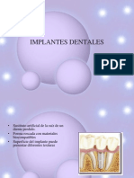 Implantesdentales 100107100224 Phpapp01