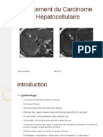 Traitement Du Carcinome Hépatocellulaire Drai Jonathan