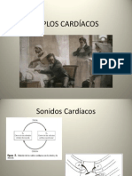 Soplos Cardíacos