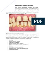 Enfermedades Periodontales