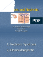 Nephritis Nephrosis