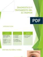 Diagnostico y Tratamiento Del Ectropion