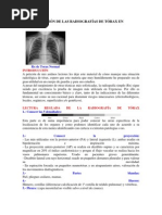 Radiografía AP y PA: Anatomía y Uso | PDF | Tórax (anatomía humana ...