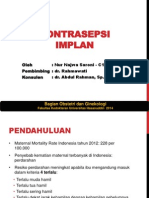 Kontrasepsi Implan