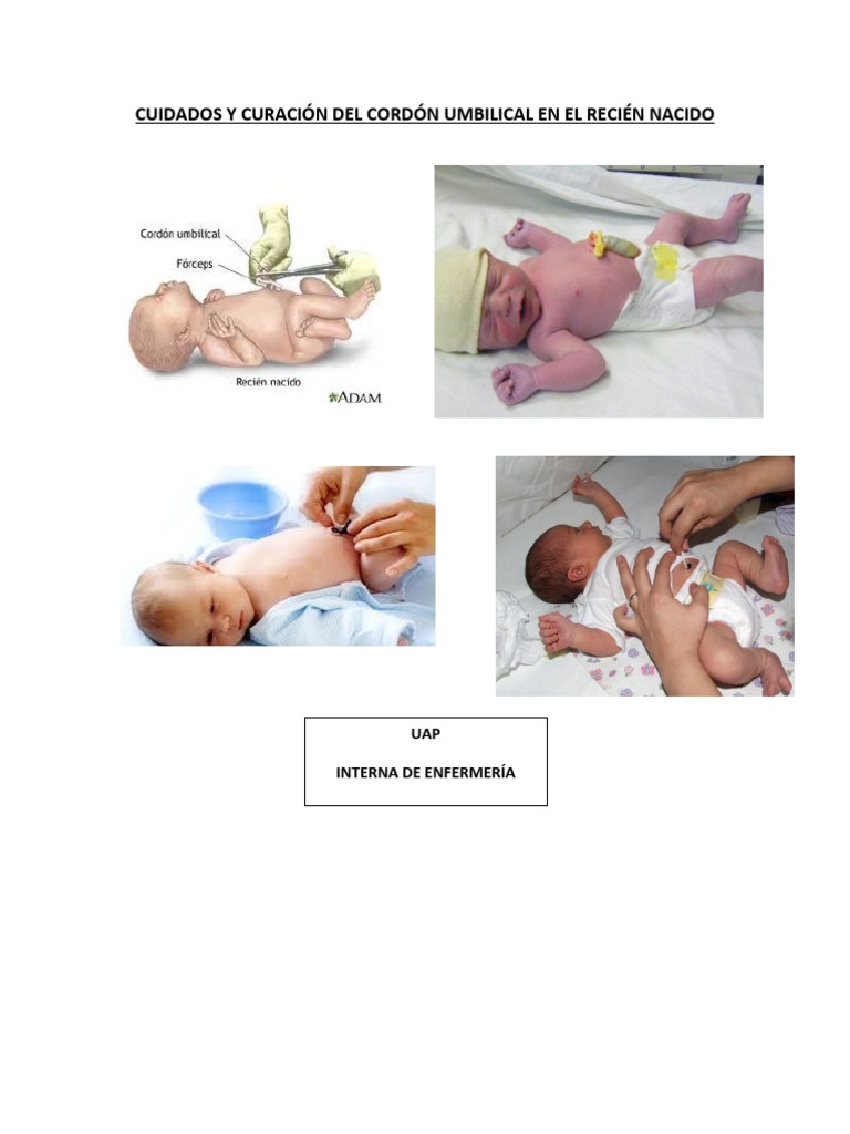 Pautas básicas para curar el cordón umbilical del recién nacido - Hospital  Manises
