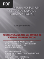 Tratamento de Paralisia Facial Com Acupuntura No Sus
