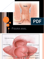 Fisura Anal