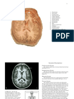 Brain and Skull MRI Anatomy