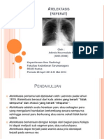 Atelektasis Radiologi