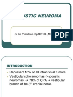 Acoustic Neuroma