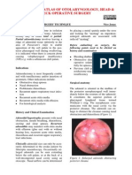 Paediatric Adenoidectomy.pdf