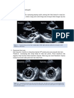 Posisi Tranduser Pada Echocardiografi