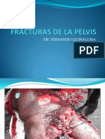 1.Fracturas de Pelvis (3)