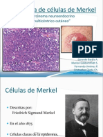 Carcinoma de Merkel