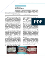 Esthetic Management of Dental Fluorosis