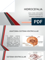 HIDROCEFALIA