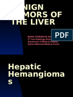 Benign Tumors of the Liver